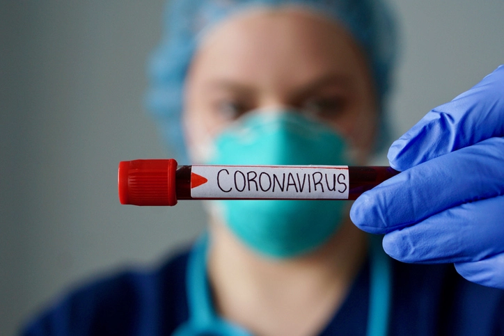 image of blood samlle for covid-19 test